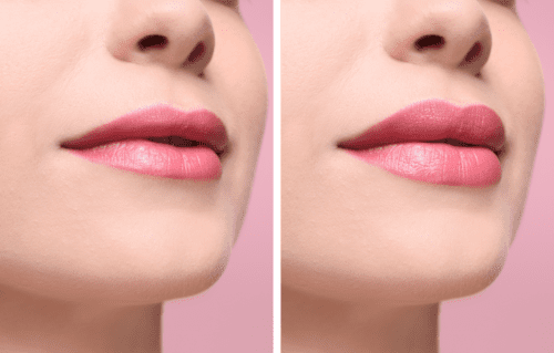 Original Injectables case photograph